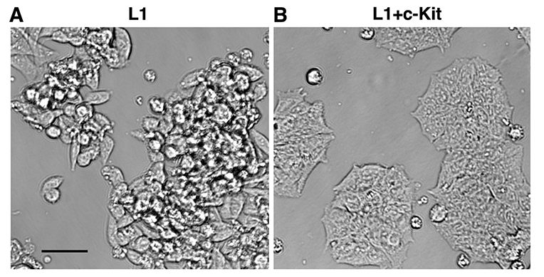 ללא הגן c-Kit מתנהגים תאי המעי הגס באופן פראי ופולשני (משמאל), אך כאשר c-Kit מתבטא כראוי, התאים חוזרים להתנהגותם המסודרת (מימין) 